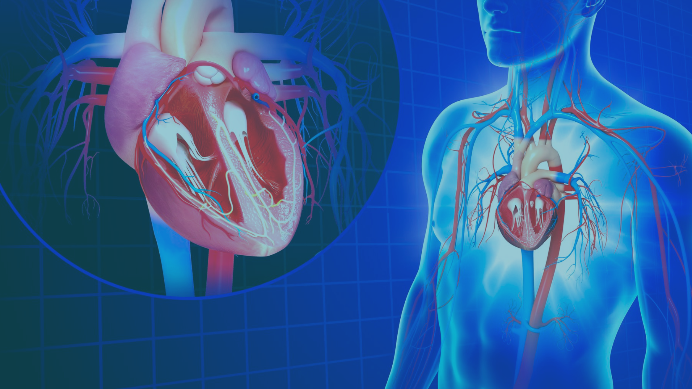 From Concept to Surgical Suite: Custom Simulations for Complex Cardiovascular Procedures